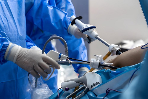 Best Laparoscopic Hernia Surgeon in Andheri
